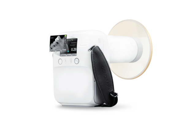 Raio x portatil & Sensor digital (Port-XIV) - Imagem 7